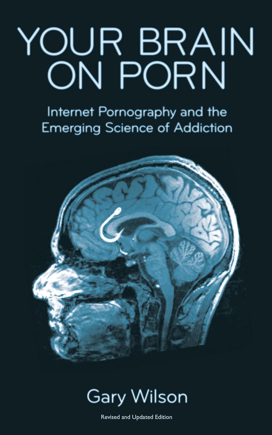 Your Brain on Porn